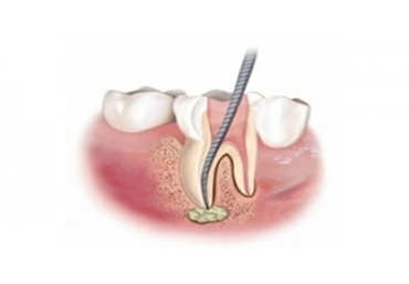 Odontoiatria conservativa - Ertodonzia - Parodontologia