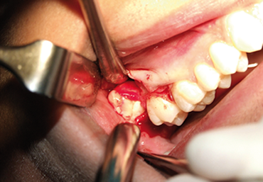 Ortodonzia Chirurgia orale